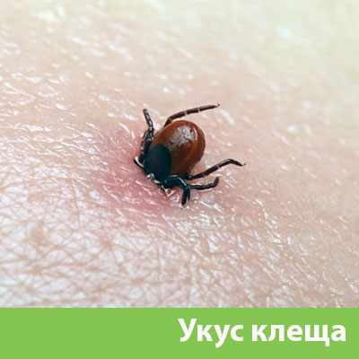 Укус клеща в Егорьевске